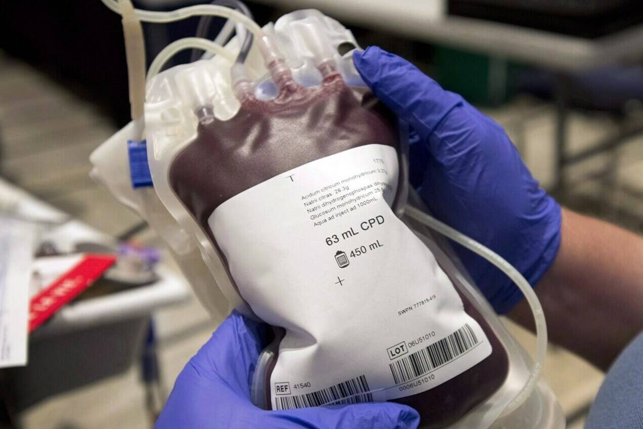 A bag of blood is shown at a clinic Thursday, November 29, 2012 in Montreal. THE CANADIAN PRESS/Ryan Remiorz