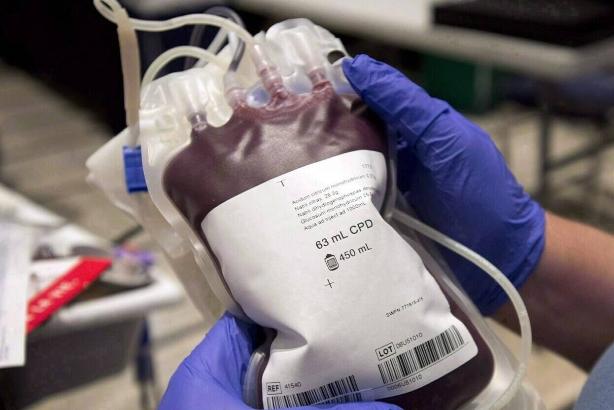A bag of blood is shown at a clinic in Montreal, Thursday, November 29, 2012. THE CANADIAN PRESS/Ryan Remiorz