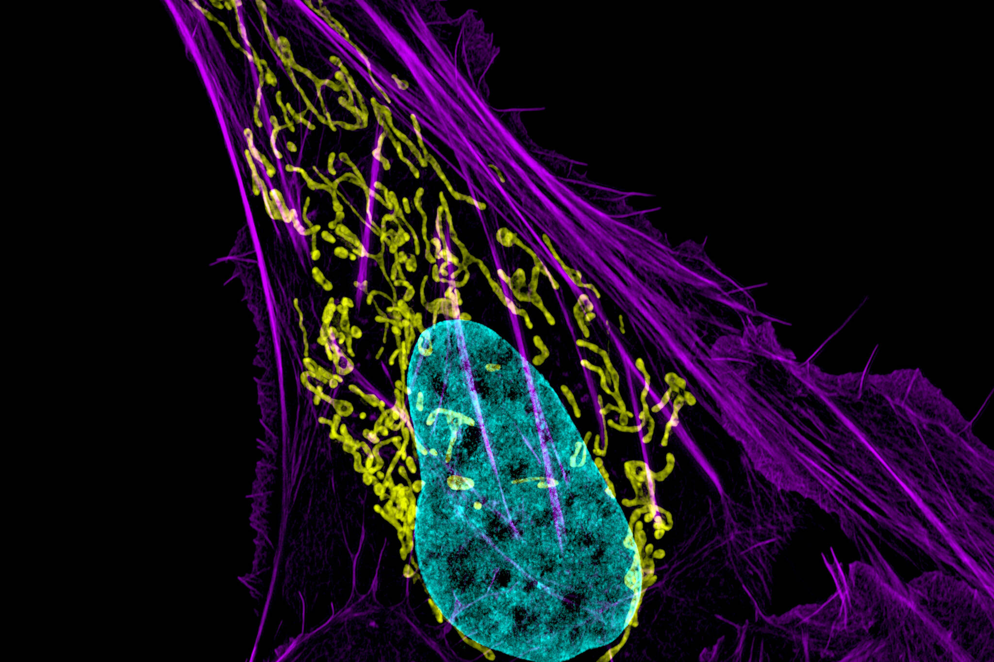 This image provided by the National Institutes of Health shows an osteosarcoma cell with DNA in blue, energy factories (mitochondria) in yellow and actin filaments, part of the cellular skeleton, in purple. Eight years ago, a team of researchers launched a project to carefully repeat influential lab experiments in cancer research. They recreated 50 experiments, the type of work with mice and test tubes that sets the stage for new cancer drugs. They reported the results Tuesday, Dec. 7, 2021: About half the scientific claims didn’t hold up. (National Institute of Health via AP)