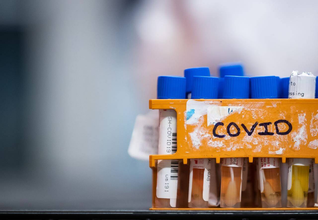 FILE – Specimens to be tested for COVID-19 are seen at LifeLabs after being logged upon receipt at the company’s lab, in Surrey, B.C., on Thursday, March 26, 2020. THE CANADIAN PRESS/Darryl Dyck