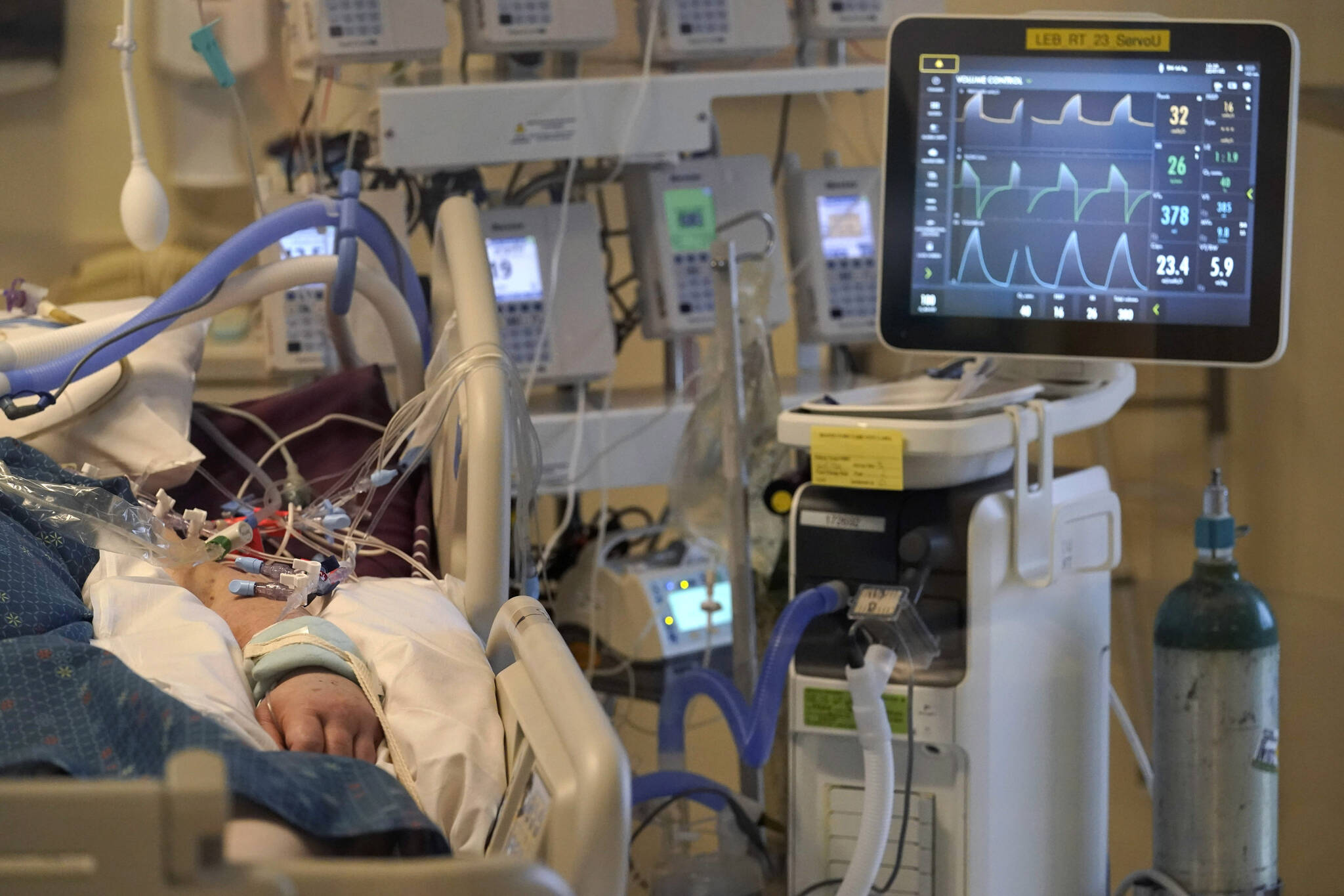 FILE - An unidentified COVID-19 patient is attached to life-support systems in the COVID-19 Intensive Care Unit. (AP Photo/Steven Senne, File)