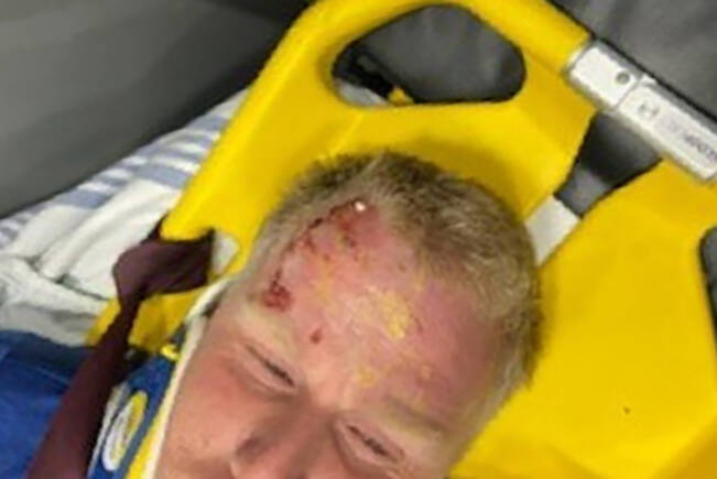 A 37-year-old Nanaimo man was knocked out after being hit with an egg thrown from a passing vehicle along Uplands Drive recently. (Photo submitted)