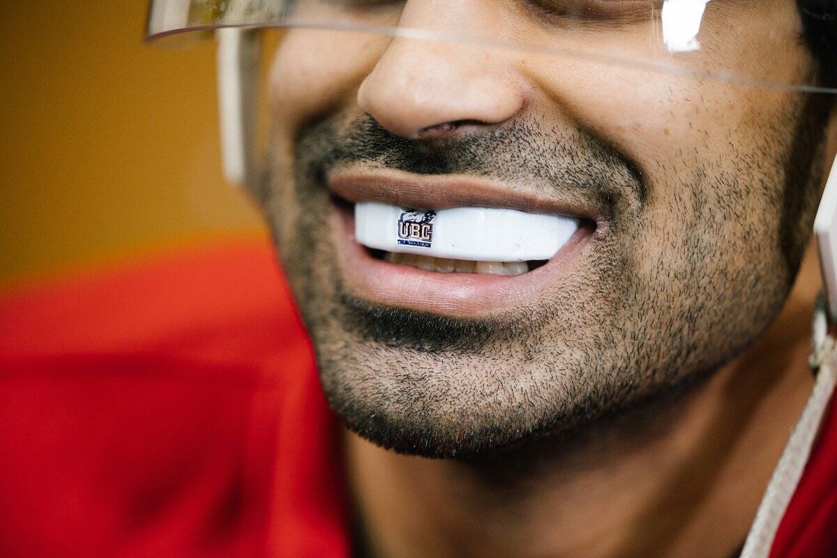 A study led by the University of British Columbia will see local men’s and women’s hockey players wear high-tech mouthguards for concussion research. (Photo: UBC Twitter)