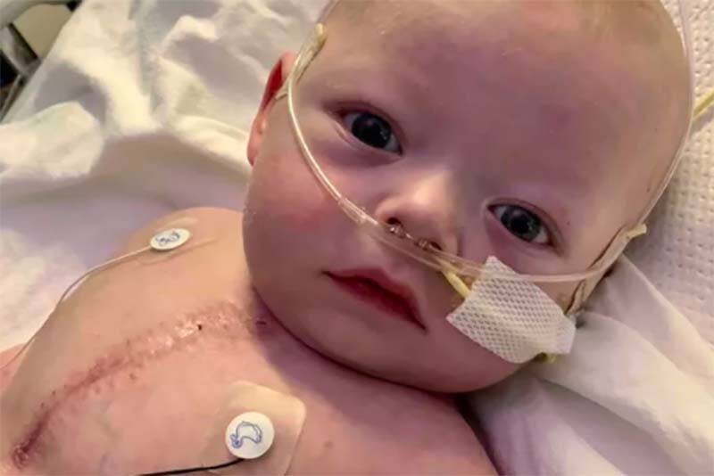 A GoFundMe campaign has begun to raise money for the parents of nine-month-old Logan Bishop of Abbotsford, who has so far had five open-heart surgeries and requires ongoing medical treatment.