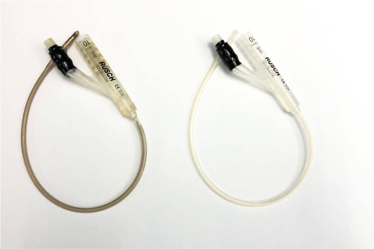 A coated (left) versus uncoated catheter. The UBC-developed coating shows promise for preventing infection from implanted medical devices. (Credit: Kizhakkedathu Lab)