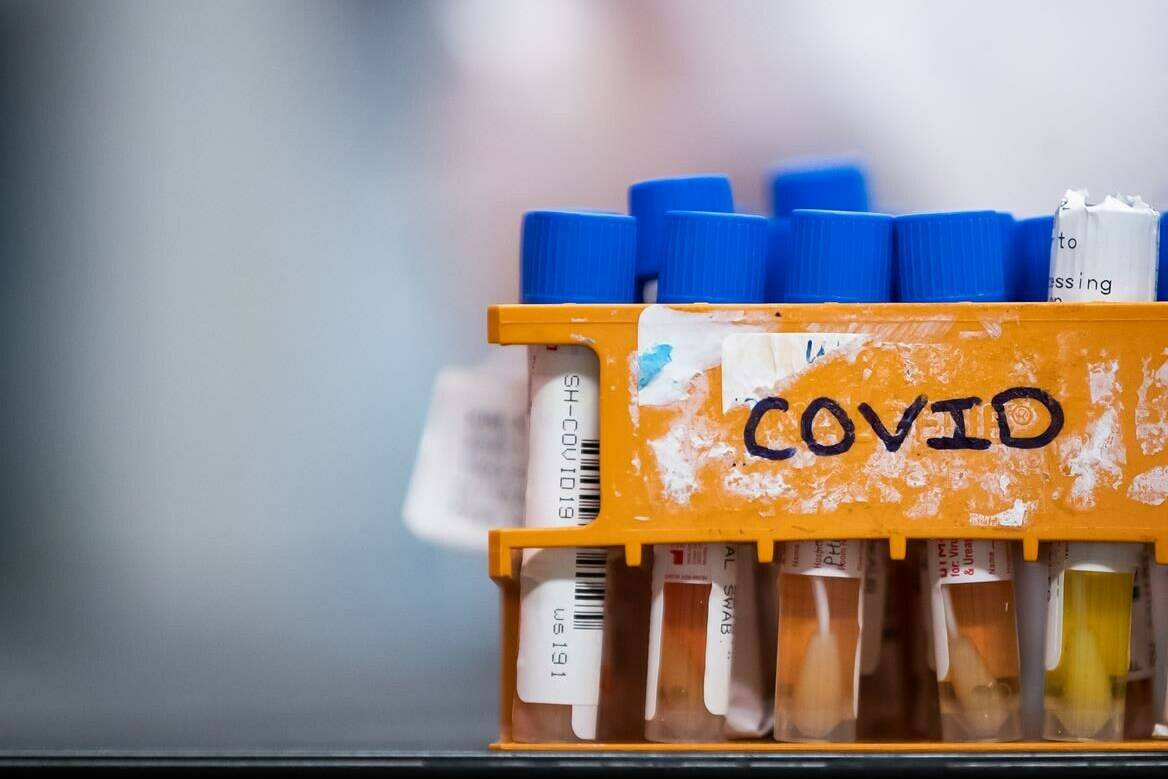 Specimens to be tested for COVID-19 are seen at LifeLabs after being logged upon receipt at the company’s lab, in Surrey, B.C., on Thursday, March 26, 2020. THE CANADIAN PRESS/Darryl Dyck