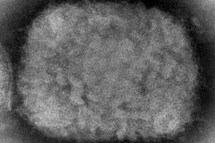 This 2003 electron microscope image made available by the Centers for Disease Control and Prevention shows a monkeypox virion, obtained from a sample associated with the 2003 prairie dog outbreak. Monkeypox, a disease that rarely appears outside Africa, has been identified by European and American health authorities in recent days. THE CANADIAN PRESS/HO - AP, CDC - Cynthia S. Goldsmith, Russell Regner