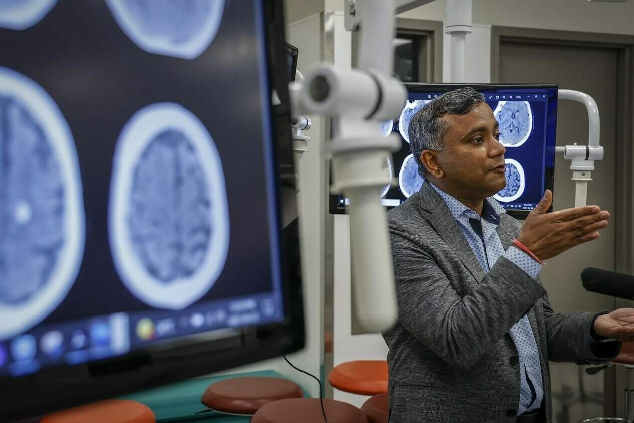 Dr. Bijoy Menon, a professor at the University of Calgary Foothills Medical Centre, describes his part in the largest stroke clinical trial ever run in Canada, in Calgary, Alta., Wednesday, June 22, 2022.THE CANADIAN PRESS/Jeff McIntosh