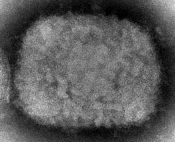 FILE - This 2003 electron microscope image made available by the U.S. Centers for Disease Control and Prevention shows a monkeypox virion, obtained from a sample associated with the 2003 prairie dog outbreak. Two children have been diagnosed with monkeypox in the United States: a toddler in California and an infant who is not a U.S. resident, health officials said Friday, July 22, 2022. (Cynthia S. Goldsmith, Russell Regner/CDC via AP, File)