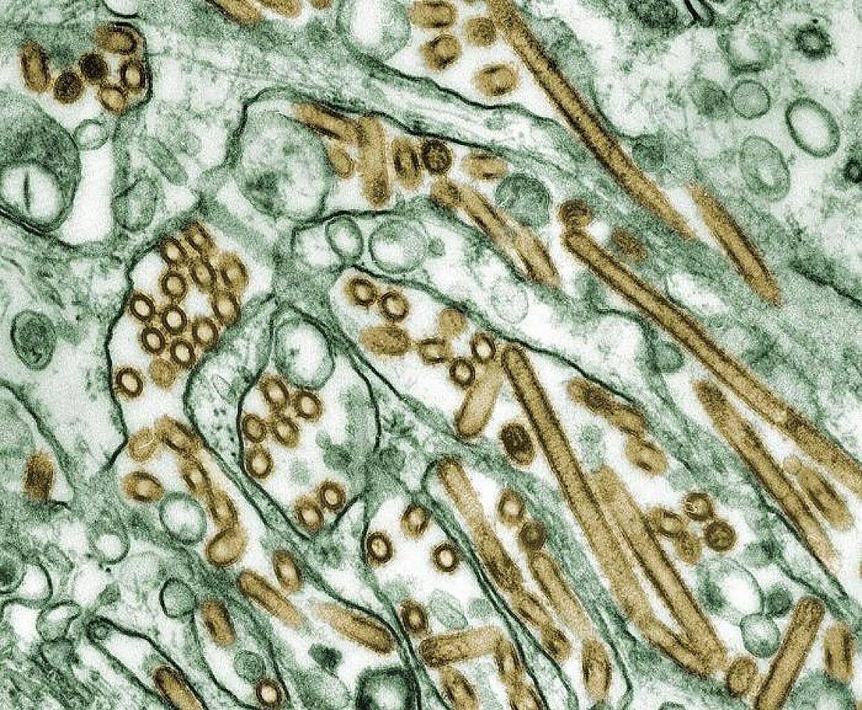 Colourized transmission electron micrograph of Avian influenza A H5N1 viruses (seen in gold) grown in MDCK cells (seen in green) as shown in this undated handout photo. A Quebec marine mammal research group says the virus could be responsible for a high number of dead seals being found in the province.THE CANADIAN PRESS/HO-CDC/Cynthia Goldsmith via NIH