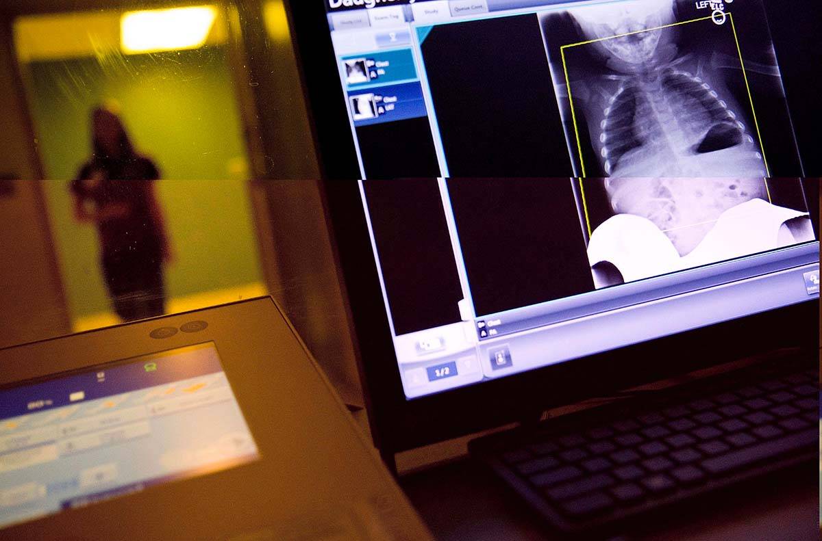 In this Feb. 9, 2018, file photo, a radiology technician looks at a chest X-ray of a child suffering from flu symptoms. Radiologists in B.C.. say hundreds of thousands of patients are waiting for medical imaging. (AP Photo/David Goldman, File)
