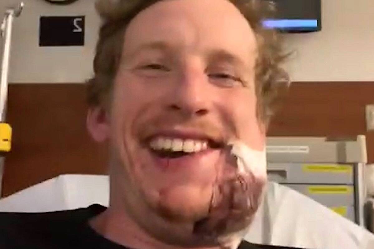 Hockey linesman Mike McGowan smiled in hospital despite a broken jaw. (Photo: gofundme.com/f/smoothie-fundraiser)