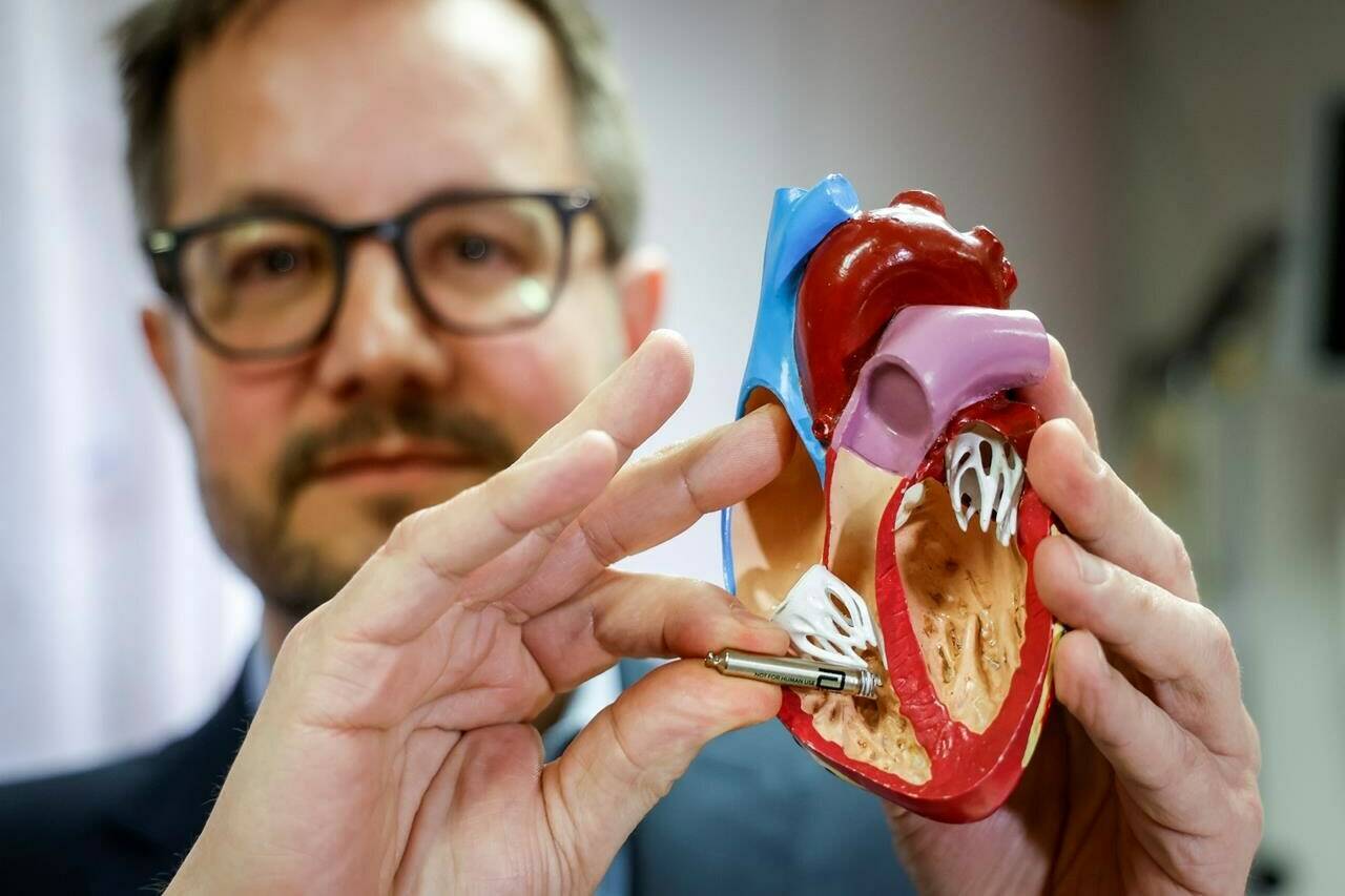 Dr. Derek Exner, a cardiologist and heart rhythm specialist with Alberta Health Services, holds an example of the miniaturized pacemaker against a model where it would be installed in a human heart at the University of Calgary medical centre in Calgary. Thursday, Feb. 9, 2023. THE CANADIAN PRESS/Jeff McIntosh