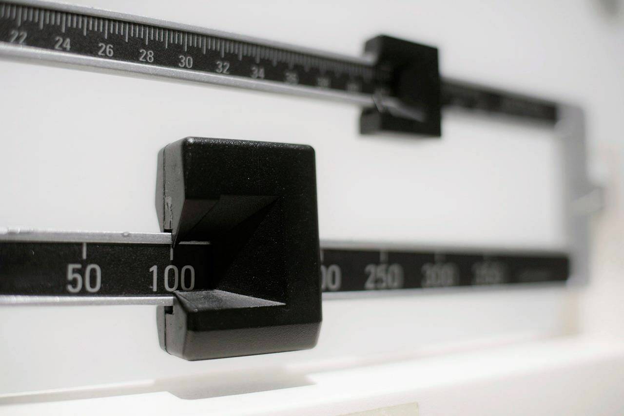 A pediatrician involved in creating new treatment guidelines for obese children in Canada says an “alarming” rise in obesity has led to a greater need for surgery as an intervention for teens whose mental and physical suffering typically worsens into adulthood. A close-up of a beam scale in New York, Tuesday, April 3, 2018. THE CANADIAN PRESS/AP-Patrick Sison