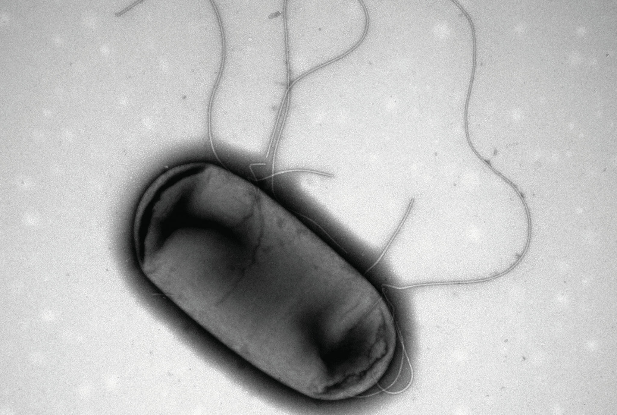 Electron micrograph image of E.coli. (File Photo)