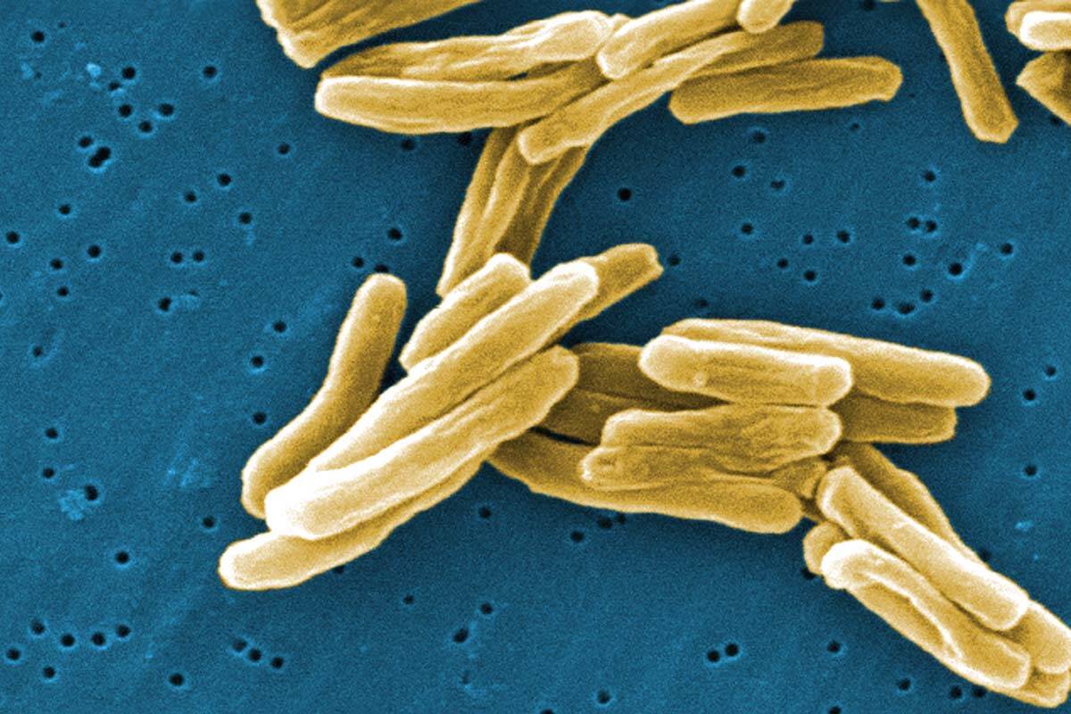 The Mycobacterium tuberculosis (TB) bacteria is shown in a 2006 high magnification scanning electron micrograph (SEM) image. THE CANADIAN PRESS/HO, CDC - Janice Carr