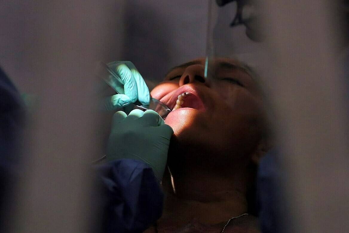 A dentist works on a patient on Monday, July 26, 2021, in San Juan, Texas. The federal housing and dental benefits rolled out last year have had “atrocious” take-up, a new report says, with hundreds of thousands of Canadians potentially missing out on the benefits. THE CANADIAN PRESS/AP-Joel Martinez/The Monitor via AP