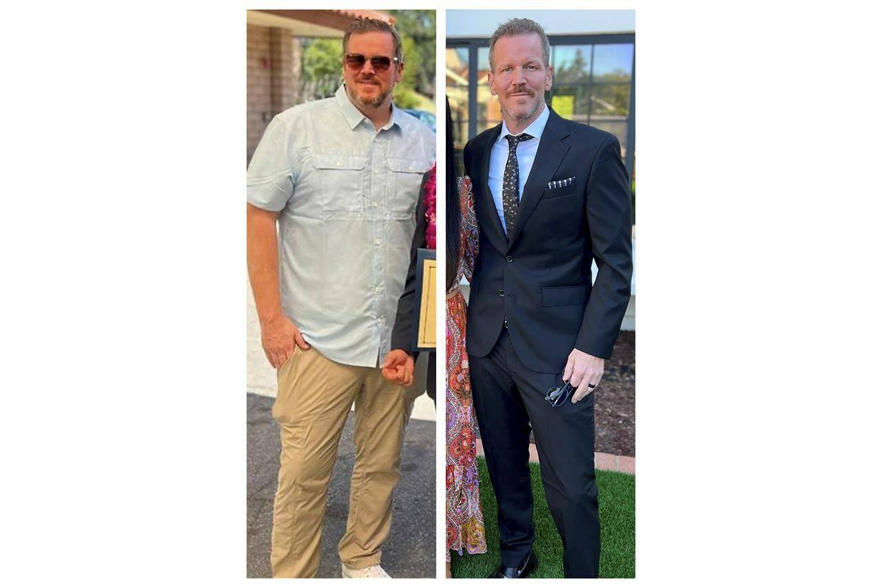 This combination of photos provided by Matthew Barlow shows him in November 2022, left, and April 2023 in California. Barlow, a 48-year-old health technology executive, said he has lost more than 100 pounds since November by using the drug Mounjaro and changing his diet. (Courtesy Matthew Barlow via AP)