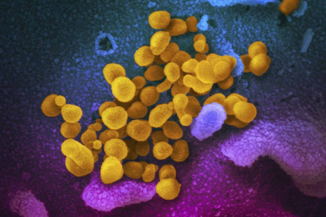 FILE - This undated, colorized electron microscope image made available by the U.S. National Institutes of Health in February 2020 shows the Novel Coronavirus SARS-CoV-2, indicated in yellow, emerging from the surface of cells, indicated in blue/pink, cultured in a laboratory. (NIAID-RML via AP, File)