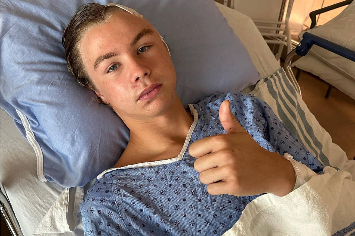 Vernon’s Gabe Kibblewhite, 14,is making an amazing recovery from serious injuries, including multiple skull fractures, after being struck by a vehicle riding his scooter on Friday, July 28. Kibblewhite is now recuperating at home. (Facebook photo)