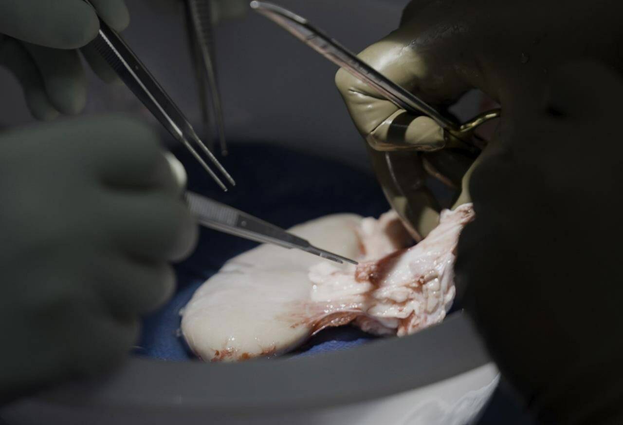 Surgeons at NYU Langone Health prepare to transplant a pig’s kidney into a brain-dead man in New York on July 14, 2023. Researchers around the country are racing to learn how to use animal organs to save human lives. (AP Photo/Shelby Lum)
