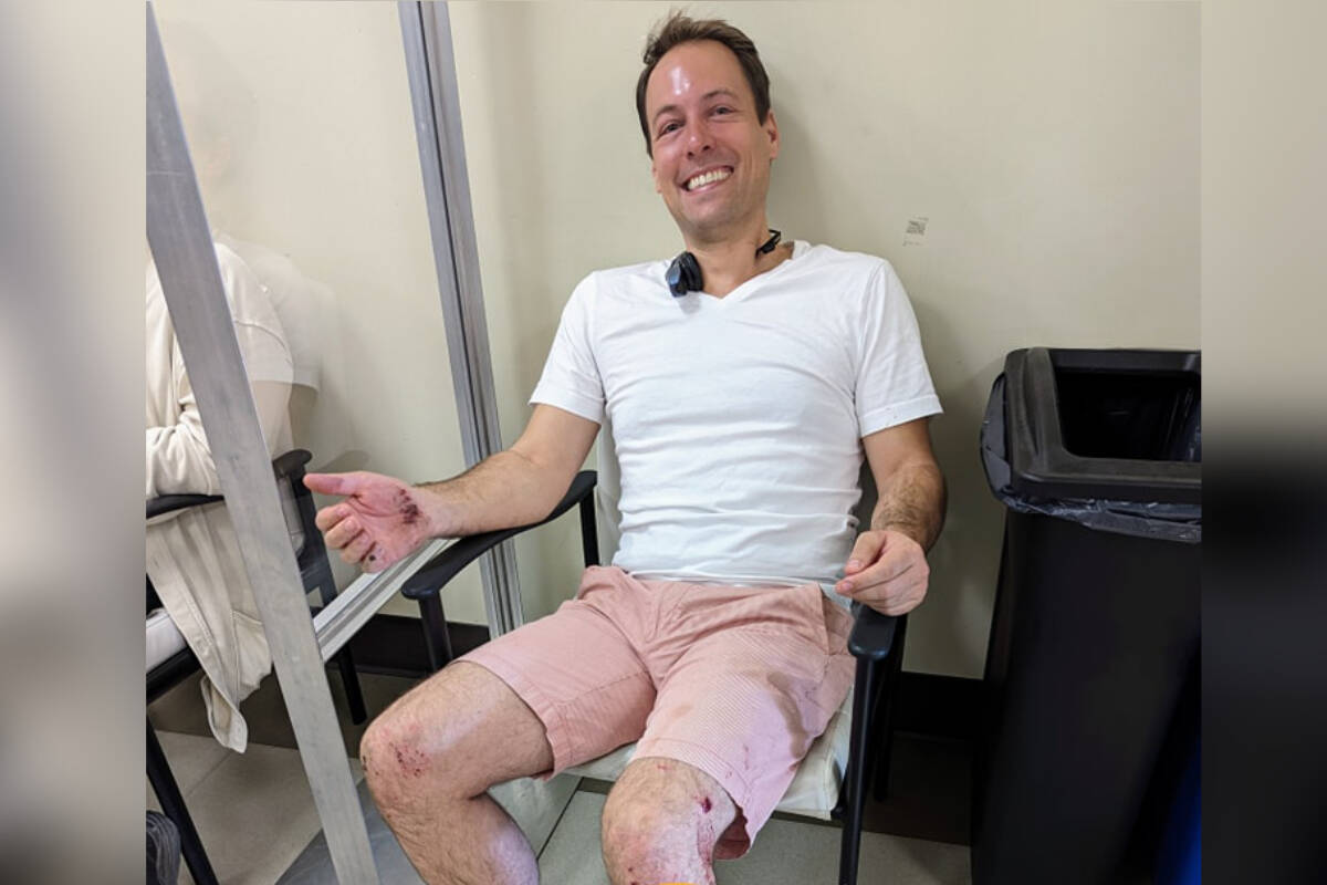 Adam Walker is grateful to medical staff at Oceanside Health Centre who patched him up after he was battered by a large buck’s horns while rescuing his dog from a scary situation. (Facebook photo)
