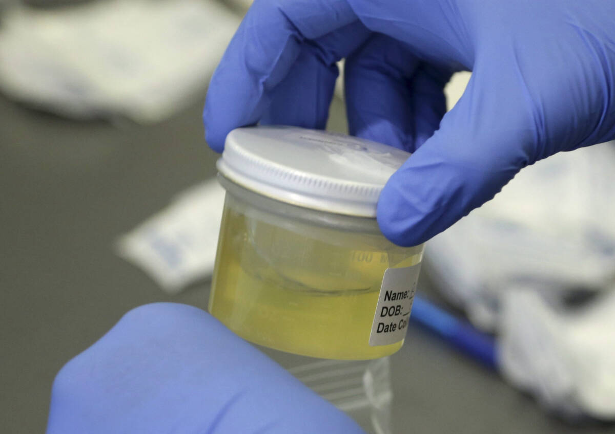 A Florida Department of Health employee processes a urine sample on Wednesday, Sept. 14, 2016. In B.C., residents in eight communities have the option of ordering their own lab requisitions for STI tests, instead of having to wait for a doctor’s appointment. (AP Photo/Lynne Sladky)