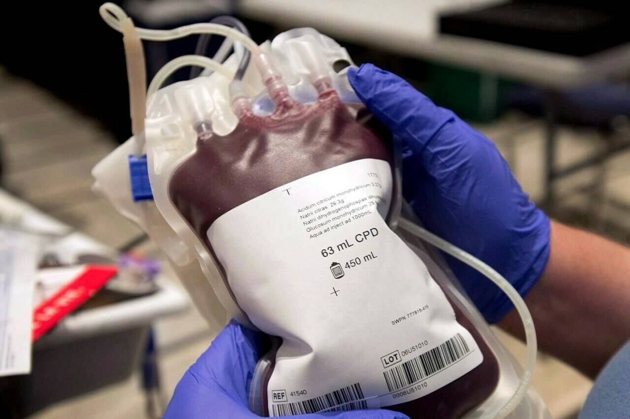 A bag of blood is shown at a clinic in Montreal, Thursday, November 29, 2012. Health Canada is lifting a longstanding ban on blood donations across the country that stemmed from fear of mad cow disease. THE CANADIAN PRESS/Ryan Remiorz