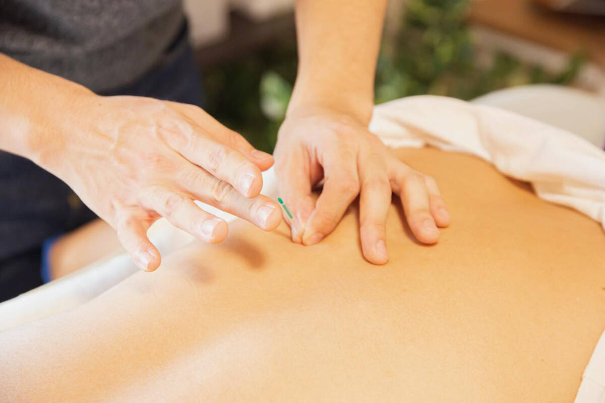 Traditional Chinese medicine treatments often include acupuncture. A B.C. crash victim has won money from a driver to help pay for this. (Pexels photo)