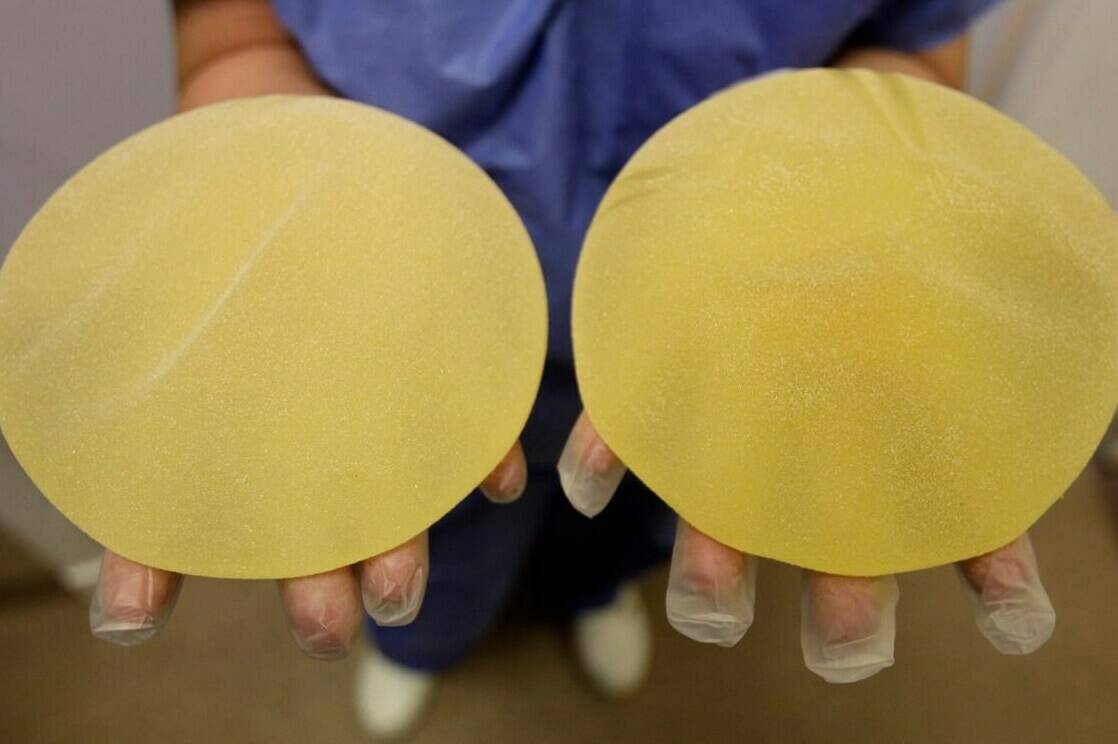 A nurse holds defective breast implants in Nice, southern France, Tuesday, Jan. 10, 2012. In Canada, the House of Commons health committee is echoing long-standing calls from plastic surgeons and patient advocates for a national breast implant registry to prevent illness and problems linked to the medical devices. THE CANADIAN PRESS/AP-Lionel Cironneau