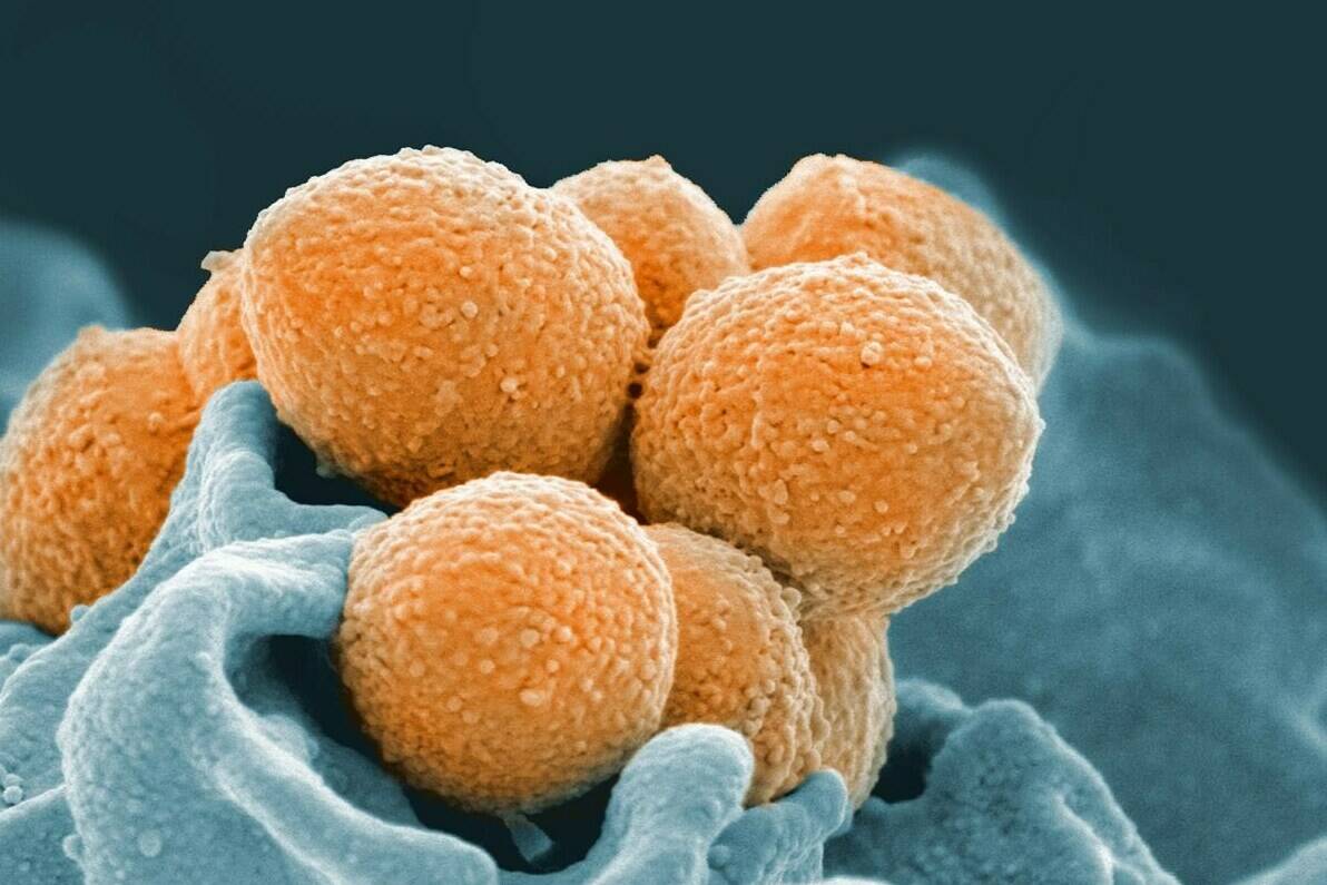 The recent deaths of six children in Ontario and four children in British Columbia from a bacterial infection is grabbing parents’ attention. Doctors say severe cases of invasive Group A streptococcal infection are extremely rare. An electron microscope image shows Group A Streptococcus in orange. THE CANADIAN PRESS/AP-NIAID via AP