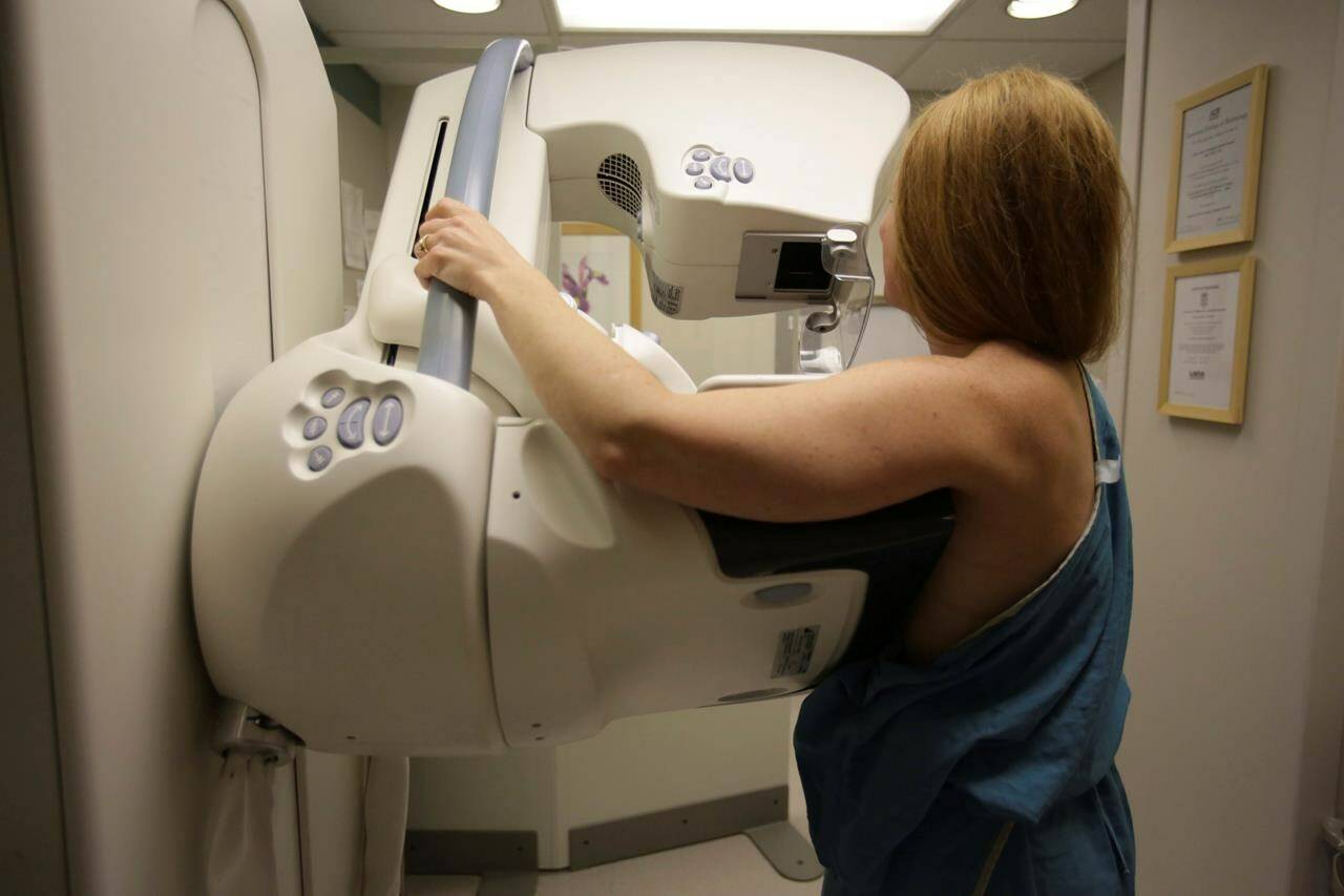 A woman gets a mammogram at the University of Michigan Cancer Center in Ann Arbor, Mich. in a May 22, 2015 file photo. THE CANADIAN PRESS/AP-Kimberly P. Mitchell/Detroit Free Press via AP