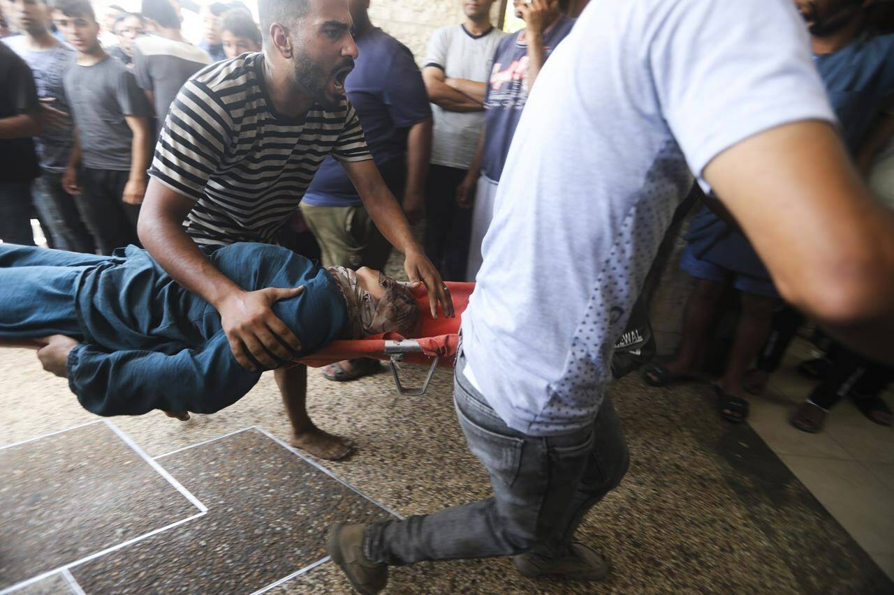 Palestinians wounded in the Israeli bombardment of the Gaza Strip arrive at al-Aqsa Hospital in Deir al-Balah, central Gaza Strip, Saturday, June 8, 2024. (AP Photo/Ismael Abu Dayyah)